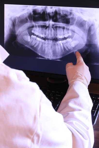Best Emergency Root Canal Treatment in Bellaire, TX