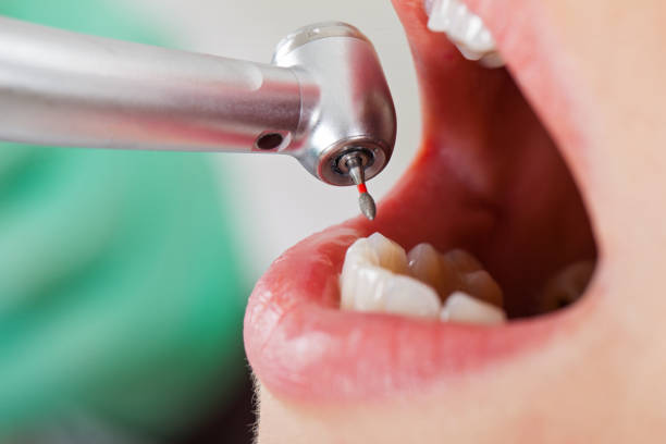 Best Pediatric Emergency Dentist in Bellaire, TX